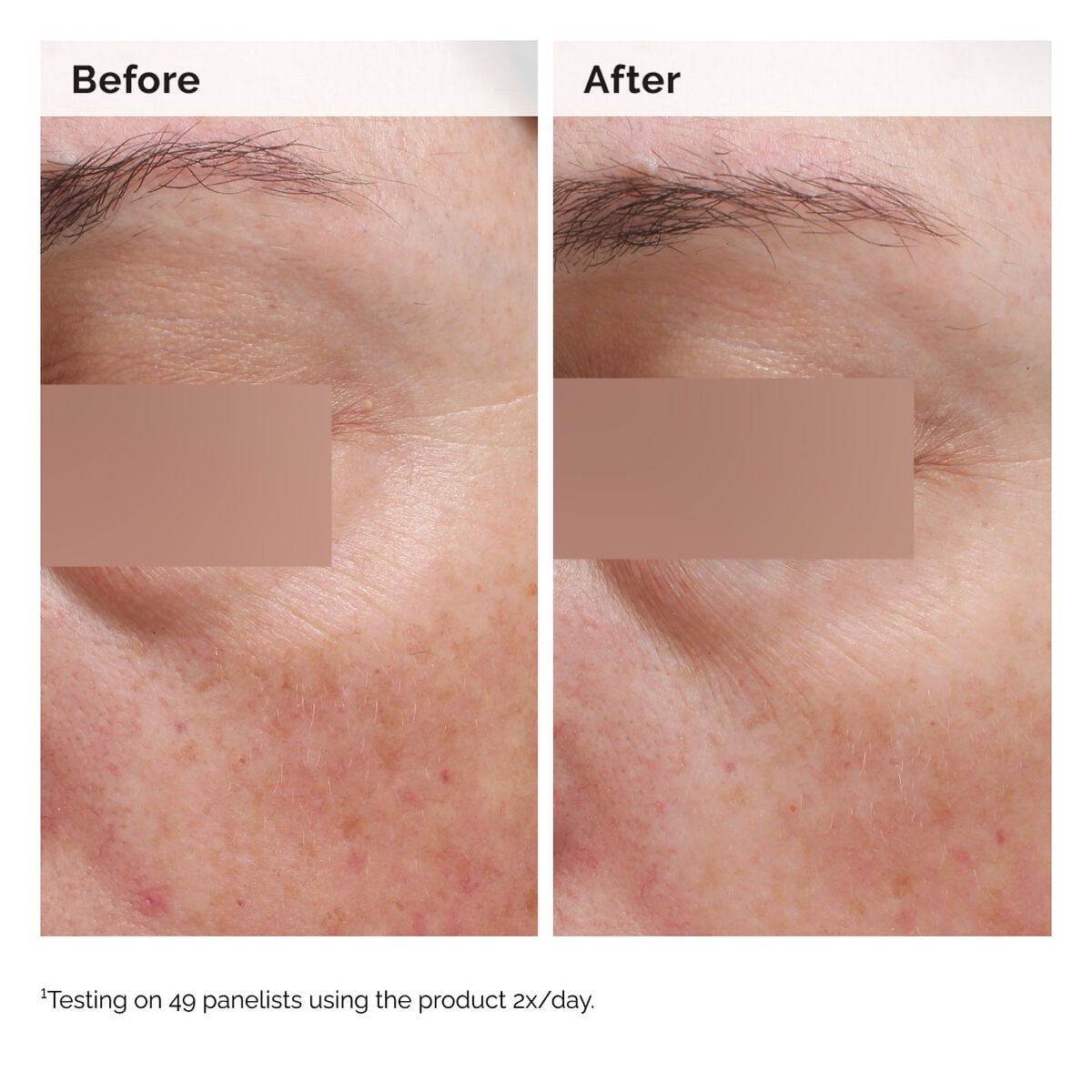niacinamide-5-face-and-body-emulsion-p9 2024-08-23-ORD-Nia-5pct-Face-Body-B-A-Elasticity-Global-02-1x1.jpg