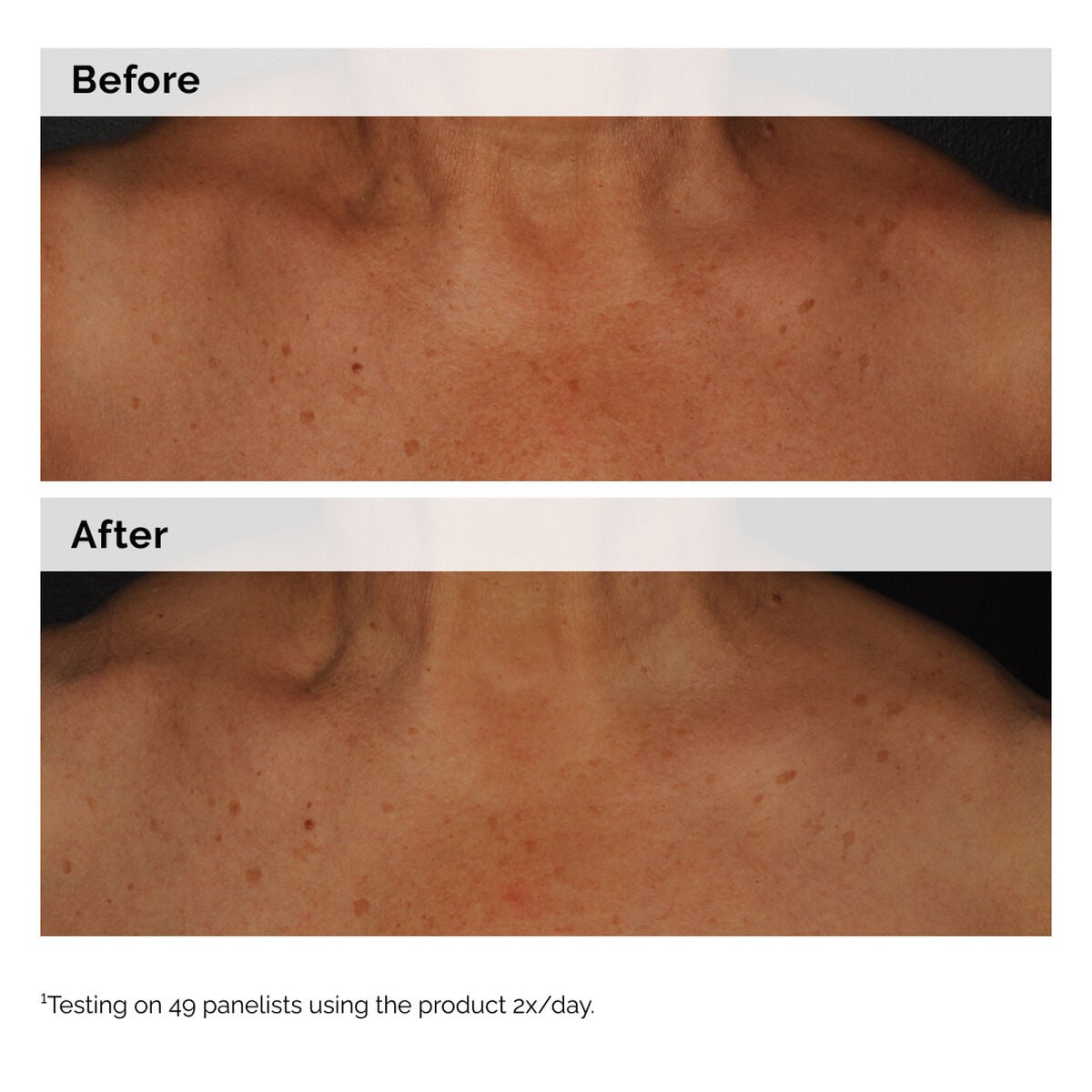 niacinamide-5-face-and-body-emulsion-p9 2024-08-23-ORD-Nia-5pct-Face-Body-B-A-Global-02-1x1.jpg