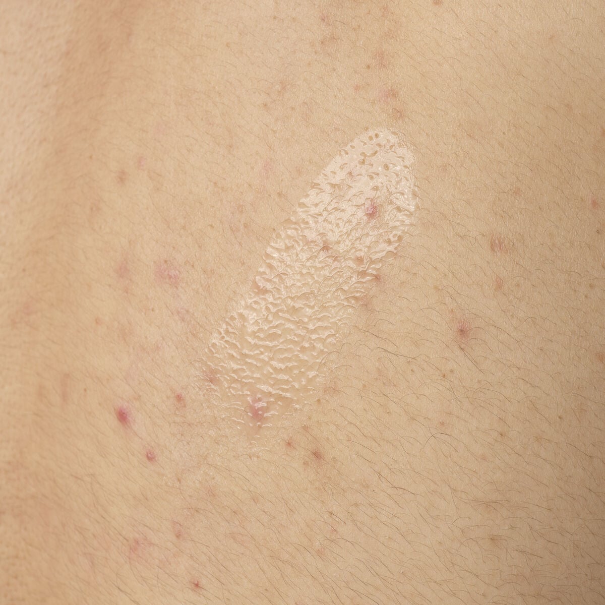 salicylic-acid-0-5-body-serum-z7 ORD-salicylic-acid-05-body-240ml-application.jpg
