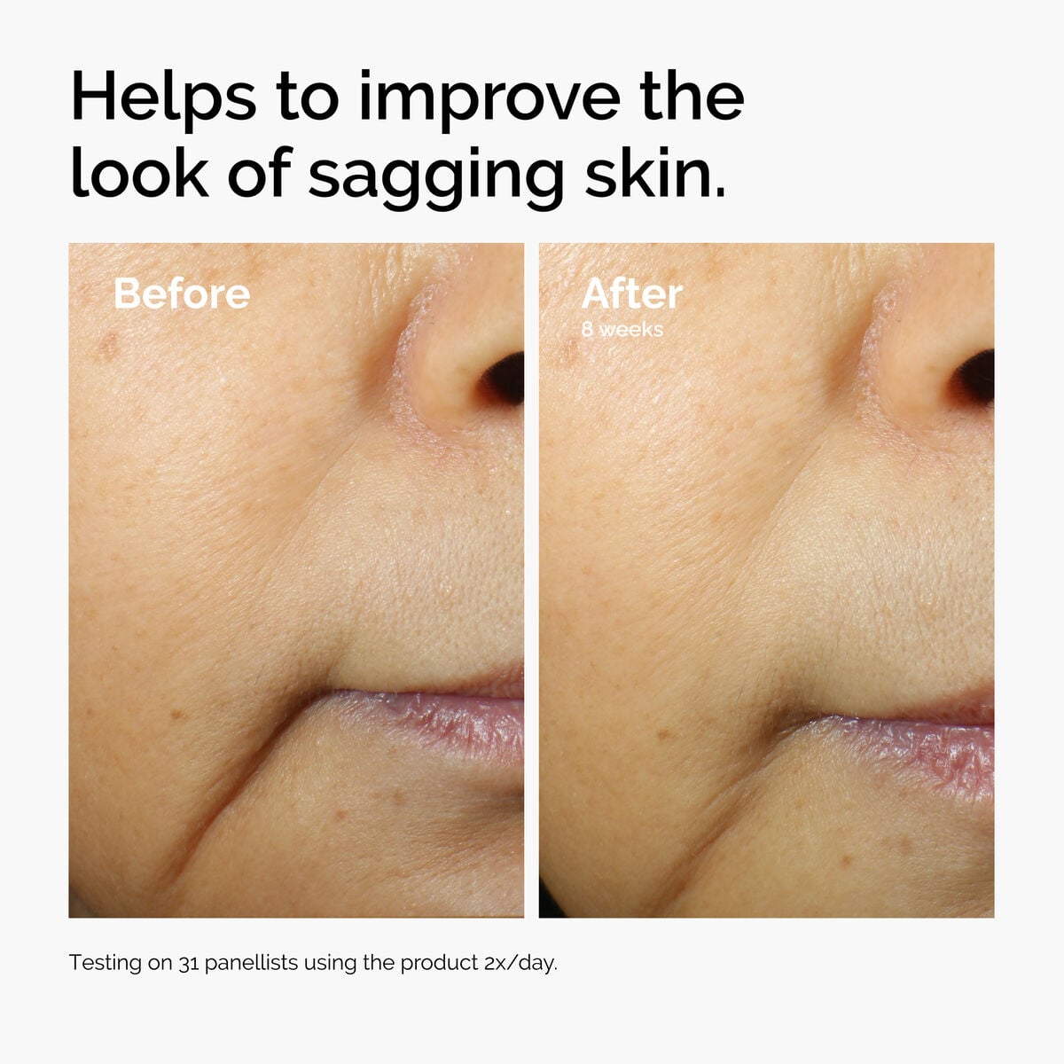 caffeine-3-escin-1-face-serum-b0 ord-caffeine-3pct-escin-1pct-face-serum-before-after-sagging.jpg