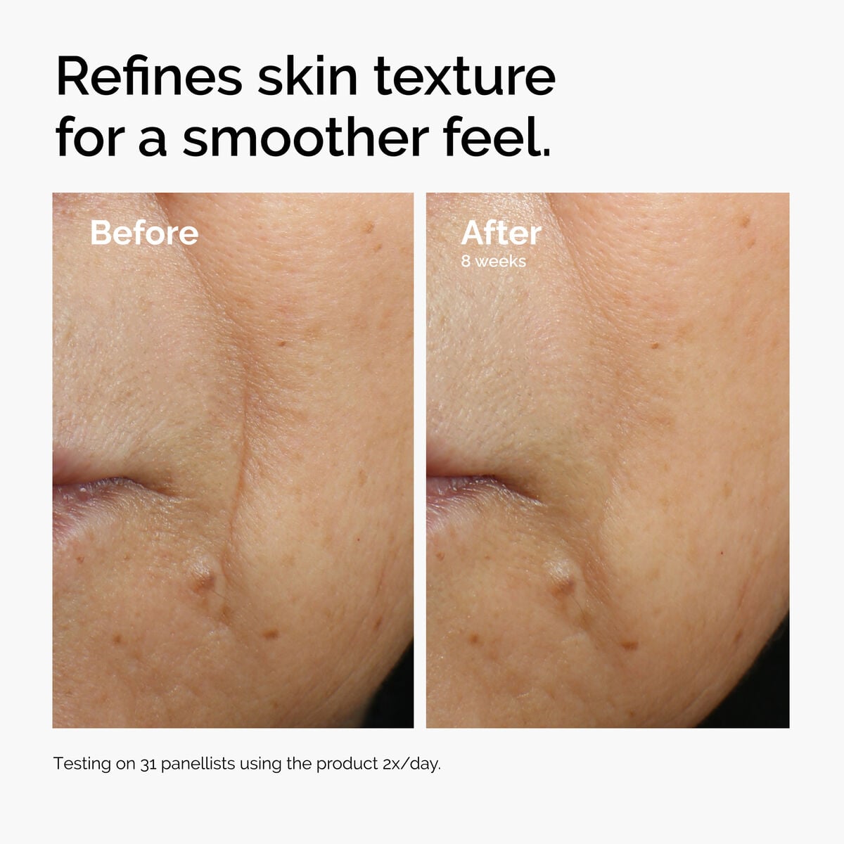 caffeine-3-escin-1-face-serum-b0 ord-caffeine-3pct-escin-1pct-face-serum-before-after-texture.jpg