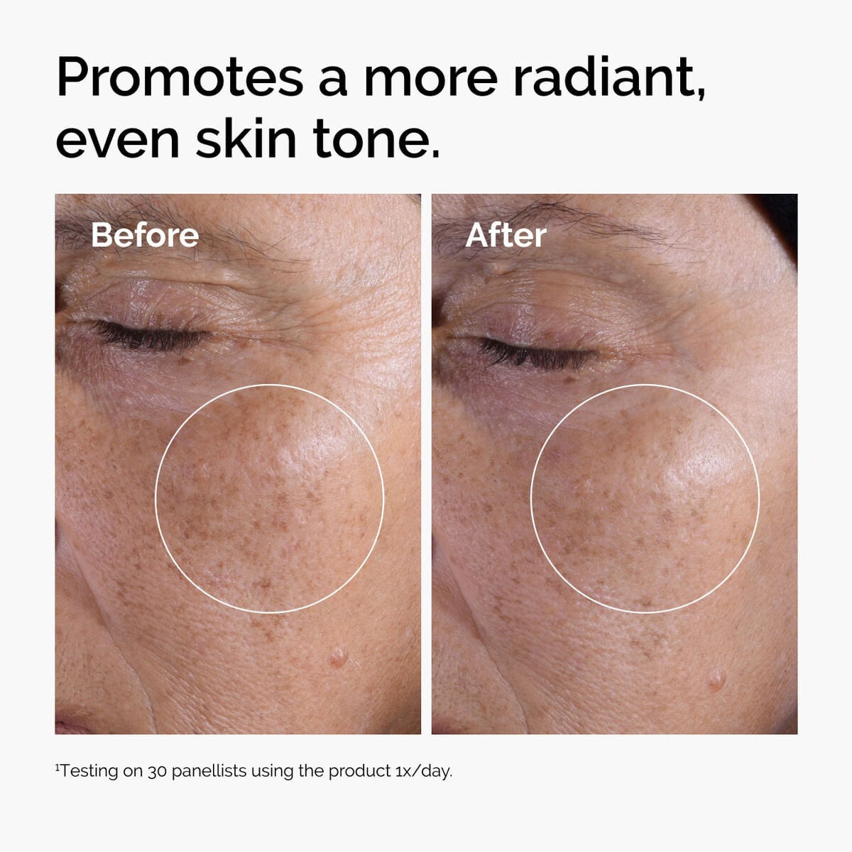 glycolic-acid-7-exfoliating-toner-c5 ord-glycolic-before-after-radiance.jpg