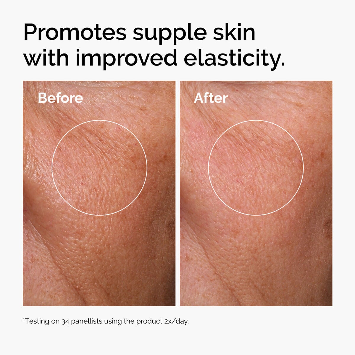 hyaluronic-acid-2-b5-with-ceramides-h2 ord-hyaluronic-acid-2pct-b5-hydrating-serum-before-after-elasticity.jpg
