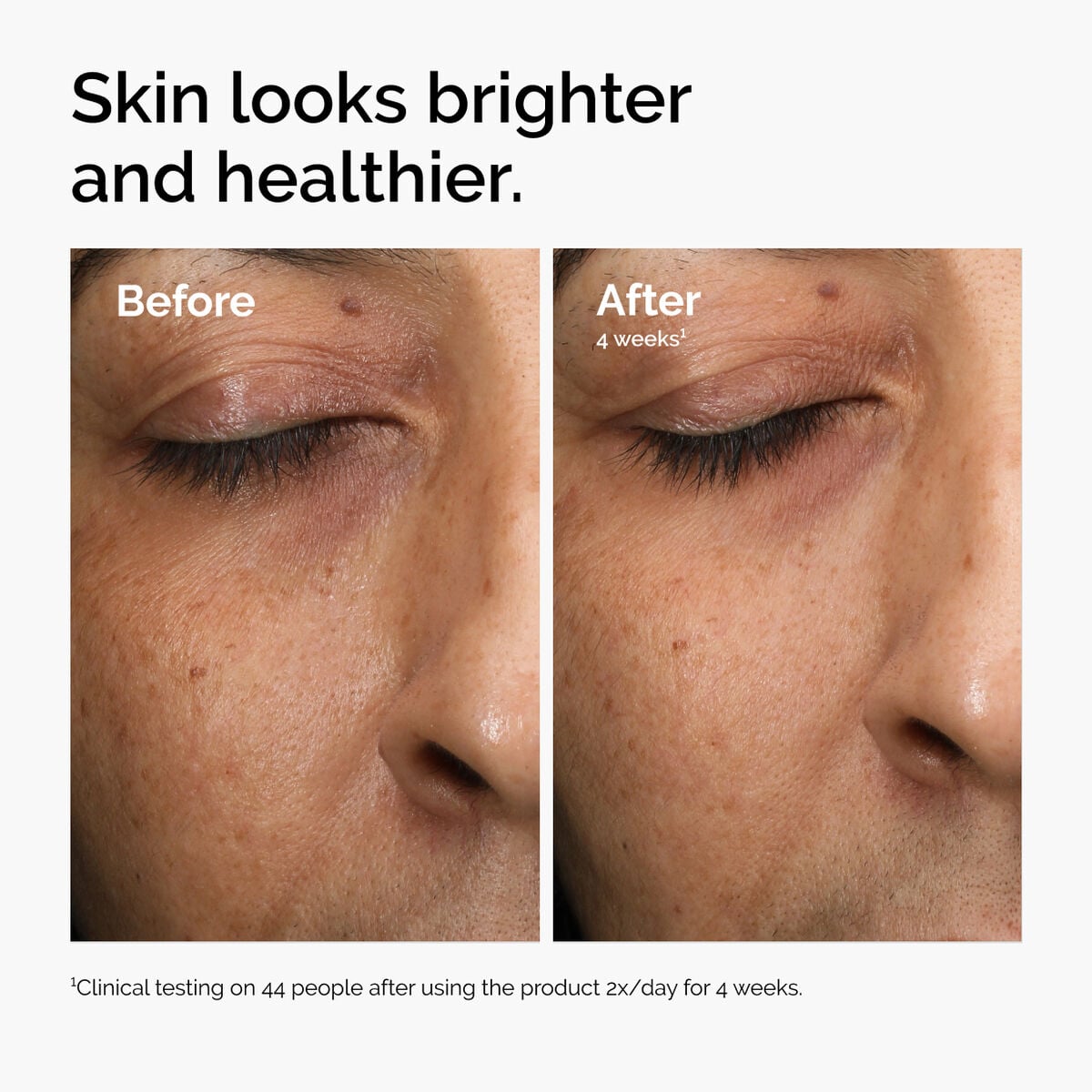 multi-antioxidant-radiance-serum-t6 ord-mars-before-after-healthy.jpg