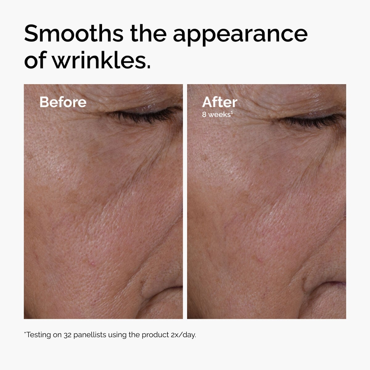 multi-peptide-ha-serum-p3 ord-multi-peptide-ha-serum-wrinkles-before-after.jpg