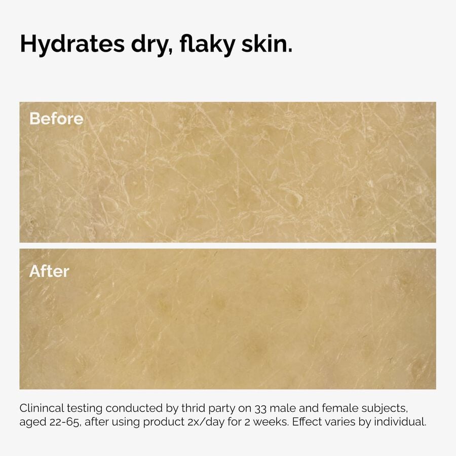 the-body-care-collection-v0 ord-natural-moisturizing-factors-inulin-body-before-after-graphic-02.jpg