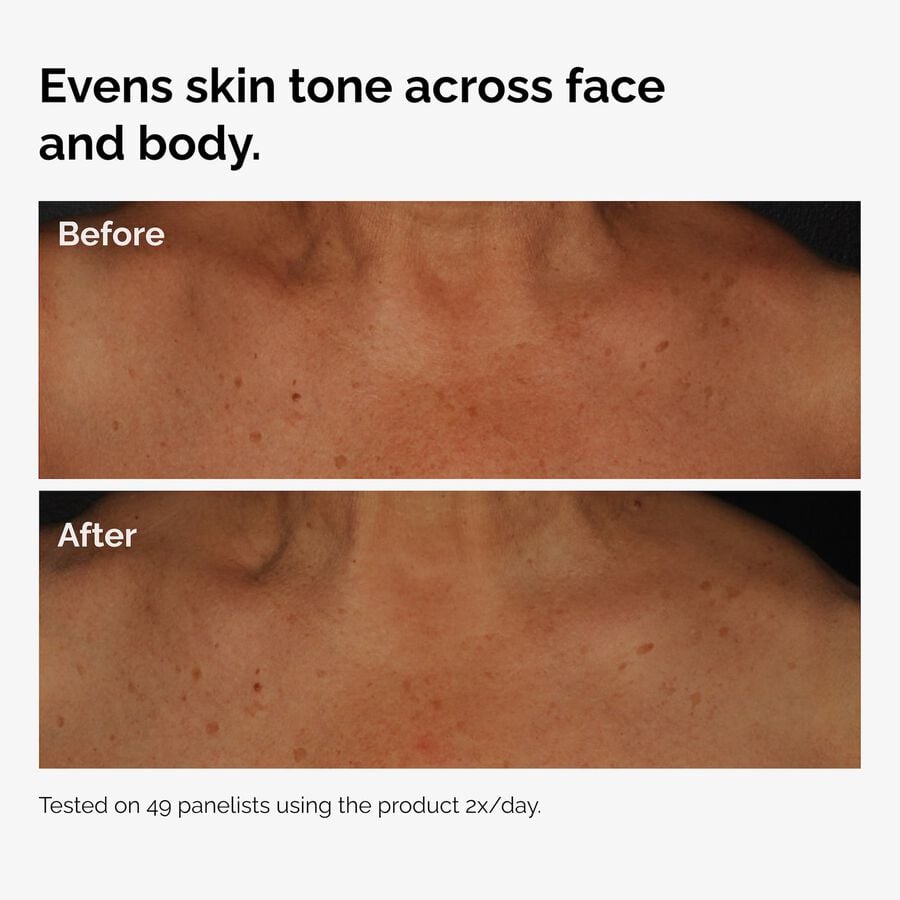 the-body-care-collection-v0 ord-niacinamide-face-body-serum-before-after-even-tone-graphic.jpg