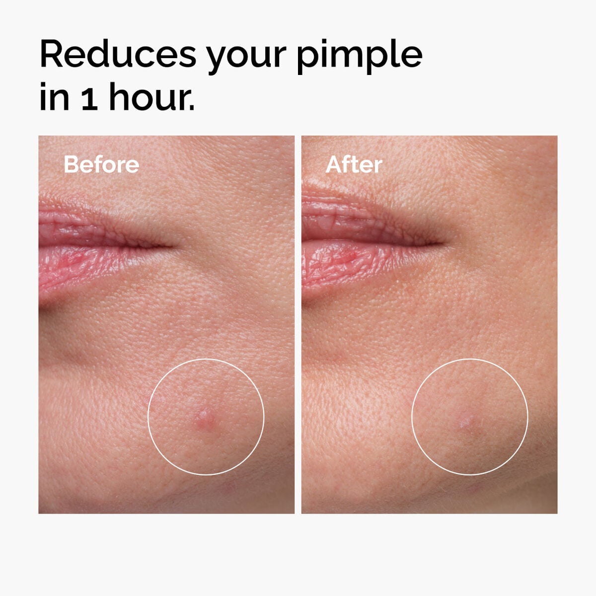 sulfur-10-powder-to-cream-concentrate-b6 ord-sulfur-10pct-powder-to-cream-concentrate-before-after-NA.jpg
